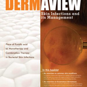 Clinical Evidence – Dermaview (Skin Infection and its Management)