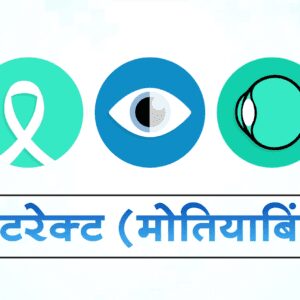 Cataract Patient Education Video in different languages